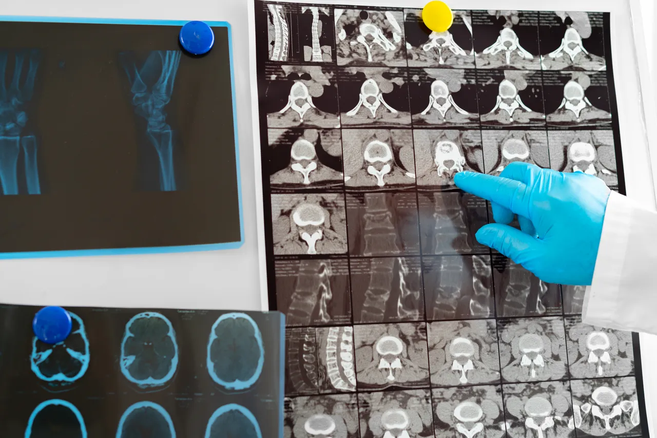 Cosa si vede nello screening? La verità sui risultati che il medico non ti spiega